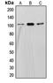 Staphylococcal Nuclease And Tudor Domain Containing 1 antibody, LS-C353392, Lifespan Biosciences, Western Blot image 