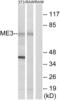 NADP-dependent malic enzyme, mitochondrial antibody, abx014641, Abbexa, Western Blot image 