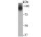 Transferrin Receptor 2 antibody, A02353, Boster Biological Technology, Western Blot image 