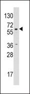 Cytochrome P450 Family 19 Subfamily A Member 1 antibody, GTX81387, GeneTex, Western Blot image 