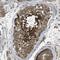 Vezatin, Adherens Junctions Transmembrane Protein antibody, PA5-53544, Invitrogen Antibodies, Immunohistochemistry frozen image 