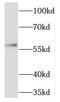 T-Box 5 antibody, FNab08541, FineTest, Western Blot image 