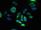 Transmembrane Protein 143 antibody, LS-C396689, Lifespan Biosciences, Immunofluorescence image 