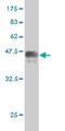 PRKR Interacting Protein 1 antibody, H00079706-M02, Novus Biologicals, Western Blot image 