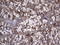 Thyroglobulin antibody, LS-C790211, Lifespan Biosciences, Immunohistochemistry paraffin image 