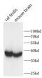 Baculoviral IAP Repeat Containing 8 antibody, FNab10464, FineTest, Western Blot image 