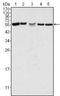 P21 (RAC1) Activated Kinase 2 antibody, NBP1-47542, Novus Biologicals, Western Blot image 