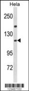 Importin 11 antibody, 63-637, ProSci, Western Blot image 