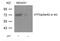 Activating Transcription Factor 2 antibody, 79-112, ProSci, Western Blot image 