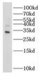 Nth Like DNA Glycosylase 1 antibody, FNab05883, FineTest, Western Blot image 