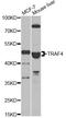 TNF receptor-associated factor 4 antibody, STJ29127, St John