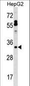 PSPB antibody, LS-C169035, Lifespan Biosciences, Western Blot image 