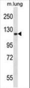 Ephrin type-A receptor 2 antibody, LS-C164374, Lifespan Biosciences, Western Blot image 