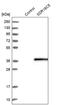 Short Chain Dehydrogenase/Reductase Family 16C Member 5 antibody, PA5-55229, Invitrogen Antibodies, Western Blot image 