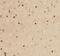 BRCA2 antibody, FNab00944, FineTest, Immunohistochemistry frozen image 