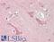 Lysine Acetyltransferase 2A antibody, LS-B13327, Lifespan Biosciences, Immunohistochemistry paraffin image 