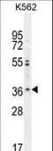 Olfactory Receptor Family 2 Subfamily M Member 3 antibody, LS-C163170, Lifespan Biosciences, Western Blot image 