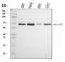 Serpin Family F Member 2 antibody, A04248-2, Boster Biological Technology, Western Blot image 