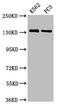 Nardilysin Convertase antibody, LS-C675125, Lifespan Biosciences, Western Blot image 