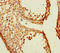 Transmembrane Protein 213 antibody, A63628-100, Epigentek, Immunohistochemistry paraffin image 