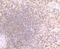 Proteasome Subunit Beta 9 antibody, A02867-1, Boster Biological Technology, Immunohistochemistry paraffin image 