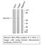 Desmin antibody, STJ97531, St John