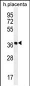 Olfactory Receptor Family 5 Subfamily AS Member 1 antibody, PA5-71636, Invitrogen Antibodies, Western Blot image 
