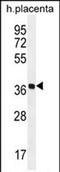 Olfactory Receptor Family 5 Subfamily AS Member 1 antibody, PA5-71636, Invitrogen Antibodies, Western Blot image 