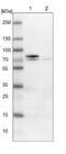 Gamma-Glutamyltransferase 7 antibody, NBP1-84319, Novus Biologicals, Western Blot image 