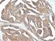 Gonadotropin Releasing Hormone Receptor antibody, V2544IHC-7ML, NSJ Bioreagents, Immunohistochemistry frozen image 