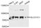 Solute Carrier Organic Anion Transporter Family Member 1C1 antibody, STJ111626, St John