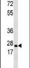 Hydroxysteroid 17-Beta Dehydrogenase 10 antibody, PA5-13330, Invitrogen Antibodies, Western Blot image 