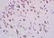Smoothened, Frizzled Class Receptor antibody, orb5757, Biorbyt, Immunohistochemistry paraffin image 