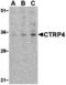 C1q And TNF Related 4 antibody, MBS150577, MyBioSource, Western Blot image 