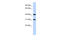 Terminal Nucleotidyltransferase 5D antibody, 26-741, ProSci, Western Blot image 