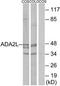 Transcriptional Adaptor 2A antibody, TA314588, Origene, Western Blot image 