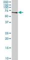 Zwilch Kinetochore Protein antibody, H00055055-D01P, Novus Biologicals, Western Blot image 