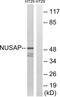 Nucleolar And Spindle Associated Protein 1 antibody, abx014677, Abbexa, Western Blot image 