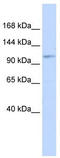 Advillin antibody, TA331180, Origene, Western Blot image 