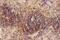 Intercellular Adhesion Molecule 1 antibody, PA5-79430, Invitrogen Antibodies, Immunohistochemistry paraffin image 
