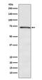 Docking Protein 1 antibody, M03039, Boster Biological Technology, Western Blot image 