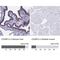 CD2 Cytoplasmic Tail Binding Protein 2 antibody, NBP2-47516, Novus Biologicals, Immunohistochemistry paraffin image 