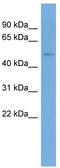 TRNA Methyltransferase 6 antibody, TA345095, Origene, Western Blot image 