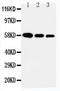 Alpha 2-HS Glycoprotein antibody, LS-C312582, Lifespan Biosciences, Western Blot image 