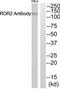 Receptor Tyrosine Kinase Like Orphan Receptor 2 antibody, TA314292, Origene, Western Blot image 