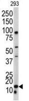 BAALC Binder Of MAP3K1 And KLF4 antibody, GTX81815, GeneTex, Western Blot image 