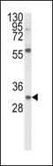 Glial Cell Derived Neurotrophic Factor antibody, MBS9212519, MyBioSource, Western Blot image 