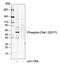 Checkpoint Kinase 1 antibody, MA5-27986, Invitrogen Antibodies, Western Blot image 