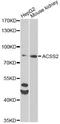 Acyl-CoA Synthetase Short Chain Family Member 2 antibody, A13596, ABclonal Technology, Western Blot image 