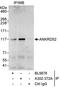 Ankyrin Repeat Domain 52 antibody, A302-372A, Bethyl Labs, Immunoprecipitation image 